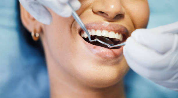 Best After-Hours Emergency Dentist in Carrizozo, NM